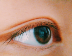 倒睫是由什么原因引起的？